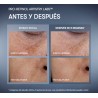 Pro-Retinol