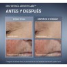 Pro-Retinol